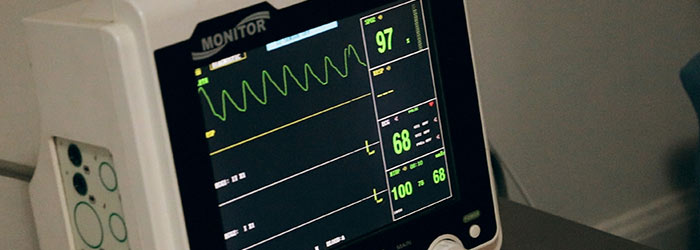 Electrocardiograma